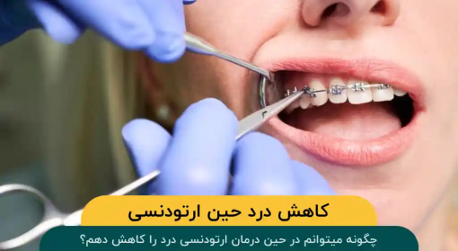 کاهش-درد-حین-ارتودنسی